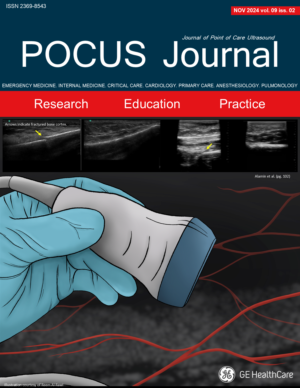 POCUS Journal cover